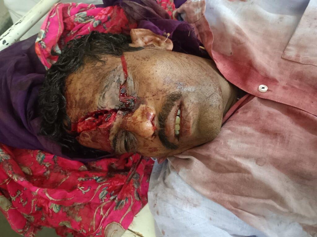 అడవిలో ఎలుగుబంటి దాడి: వ్యక్తికి తీవ్ర గాయాలు