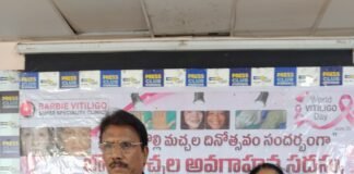 బొల్లిమచ్చలు (విటిలిగో) చికిత్సలో ఆధునిక సాంకేతికతలు అందుబాటులోకి